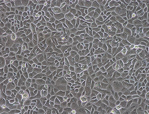 CTB_epidermal_keratinocytes_01.jpg