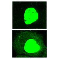 アセチル化された細胞質および核タンパク質の免疫蛍光染色