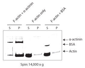 ActinAbZC