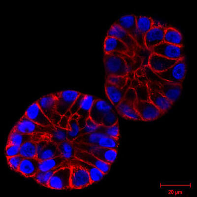 マトリゲル上で培養したSiR-actin染色（赤色）H2B-GFP（青色）発現MCF10A 細胞。