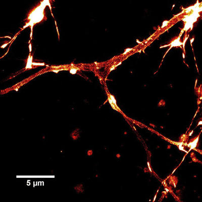 SiR-actinで染色した培養したラット海馬ニューロンのSTED画像。