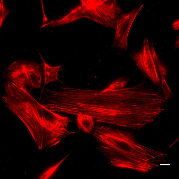 SiR700-actinで染色したSwiss 3T3線維芽細胞