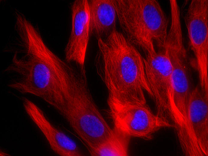 SiR700-tubulinで染色した線維芽細胞