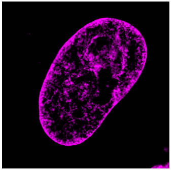 HeLa細胞をSPY555-DNAプローブで染色