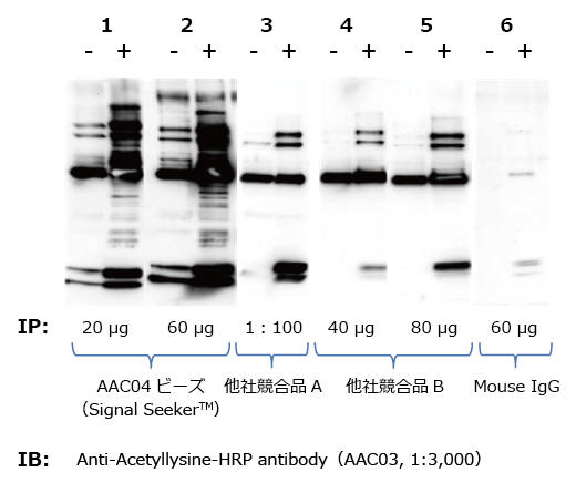 AAC04によるアセチル化リジンタンパク質の免疫沈降