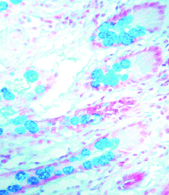 染色結果（品番 KT 002、pH 1.0）-ヒト結腸のアルシアンブルー染色