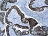 DBS_chromogens_7.jpg