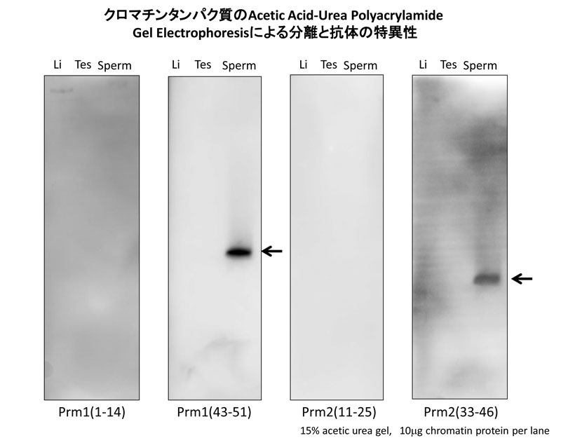 クロマチンタンパク質の Acetic Acid-Urea Polyacrylamide Gel Electrophoresis による分離と抗体の特異性