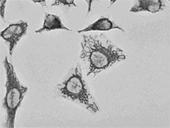 Biotin標識抗体での染色例
