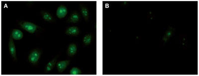 Nucleolar-ID GreenŐFזE̓pl`Ō悤ɁAj̓̋uVOiA܂זEjւ̎アu