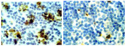 ヒドロコルチゾン処理したマウス胸腺（左図）とコントロール（右図）の顕微鏡写真