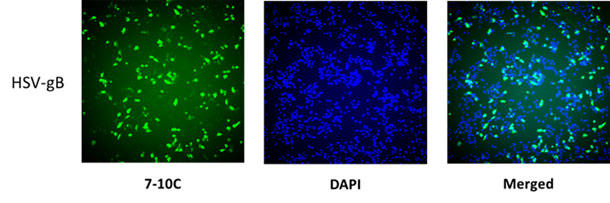 免疫蛍光染色によるHSV-gBまたはHSV-gD発現細胞の検出