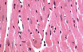 マウス心臓のパラフィン切片（5μm）を FD ヘマトキシリン（青）、FD エオシンY（赤）で染色した。