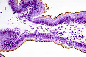 ラット前立腺の凍結切片（12 µm）をサイトケラチン18で免疫染色し（茶色）、その後 FD クレシルバイオレット溶液で対比染色した。