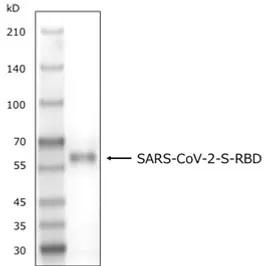 SDS-PAGE