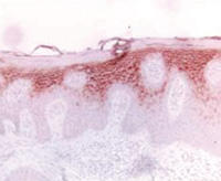 ヒト乾癬性皮膚組織のパラフィン切片を抗Elafinポリクローナル抗体（品番：HP9025）で染色した。