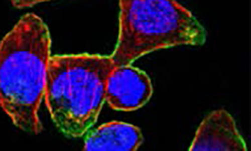 antibody