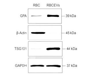 JOT_EV_standard_Fig02.jpg