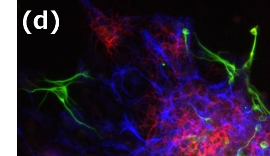 KJN_neural_stem_cell_02d.png