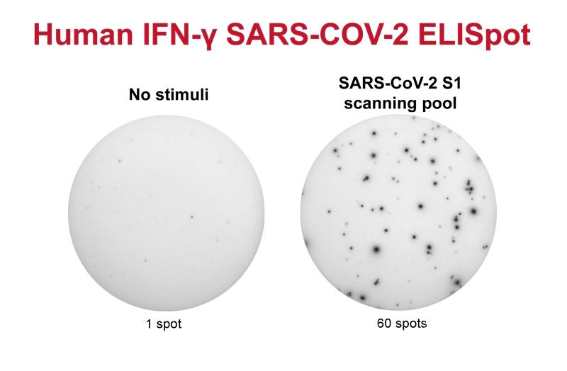 Human IFN-gannma SARS-COV-2 ELISpot