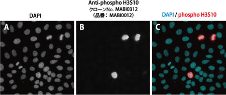 図1　リン酸化ヒストンH3（Ser10）抗体（品番：MABI0312）を用いた免疫染色