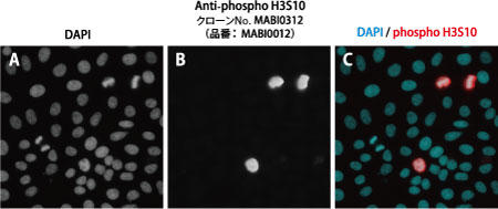 Fig. 1 Immunostaining using phosphorylated histone H3 (Ser10) antibody (Product number: MABI0312)