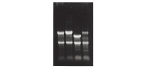 TRI Reagent(R) 品番：TR118 を用いてトータルRNAを抽出