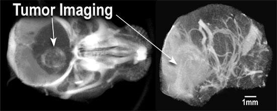 マウス脳のmicroCT画像