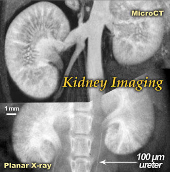 マウス腎臓の生体イメージング