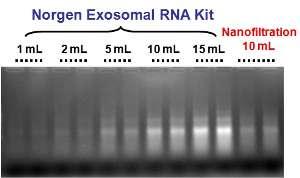 各用量の尿からのエキソソームRNA抽出