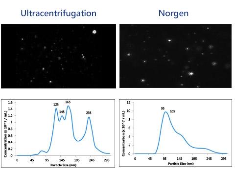Norgen社キットまたは超遠心法を用いて無傷のエクソソームを10 mLの尿サンプルから精製
