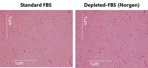 クソソーム除去FBSを使用したHeLa 細胞増殖率
