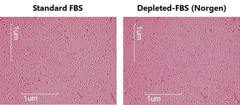 エクソソーム除去FBSを使用したHeLa 細胞増殖率