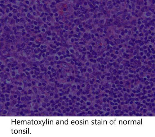 正常な扁桃のヘマトキシリン・エオジン（HE）染色
