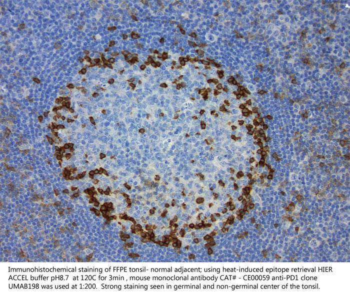 扁桃と隣接した正常組織（FFPE）の免疫組織染色