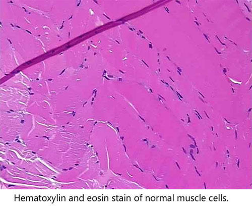 正常な筋細胞のヘマトキシリン・エオジン（HE）染色