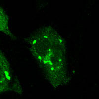 RC100004:ATG12 with C-tGFP tag for Autophagosome marking