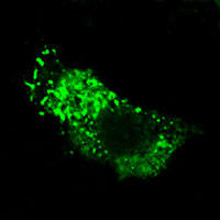 RC100008FCALR (ETS) with mRFP tag for Endoplasmic Reticulum marking