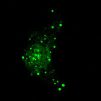 RC100020FMAP1LC3A with N-tGFP tag for Autophagosome marking