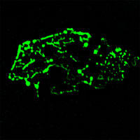 RC100022FPFN1 with N-tGFP tag for Cytoskeleton marking