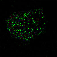 RC100024FPXMP2 with N-tGFP tag for Peroxisome marking