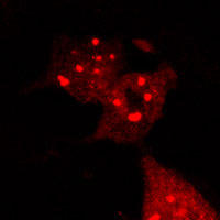 RC100036:ATG12 with C-tRFP tag for Autophagosome marking