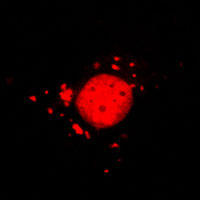 RC100052FMAP1LC3A with N-tRFP tag for Autophagosome marking