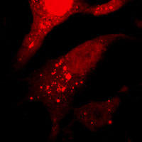 RC100053:MAP1LC3B with N-tRFP tag for Autophagosome marking