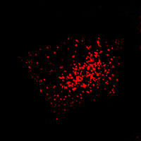 RC100056FPXMP2 with N-tRFP tag for Peroxisome marking