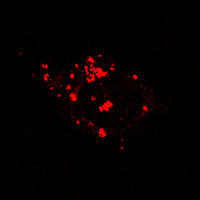 RC100059FRhoB with N-tRFP tag for Endosome marking