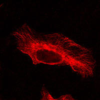 RC100062FTUBA1B with N-tRFP tag for Cytoskeleton marking