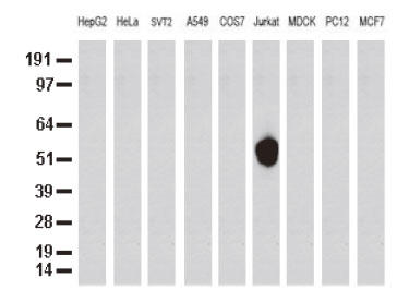 9̍זẺntanti-CD5 mN[iR̂WB