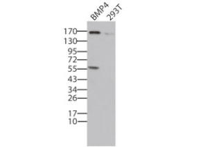 pCMV6-ENTRY BTRC cDNA