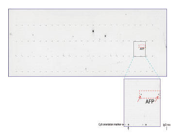 OriGen Ђoverexpression protein microarray chip UltraMAB anti-AFP }EXmN[iR̂pĖƉuFiUM500056jB